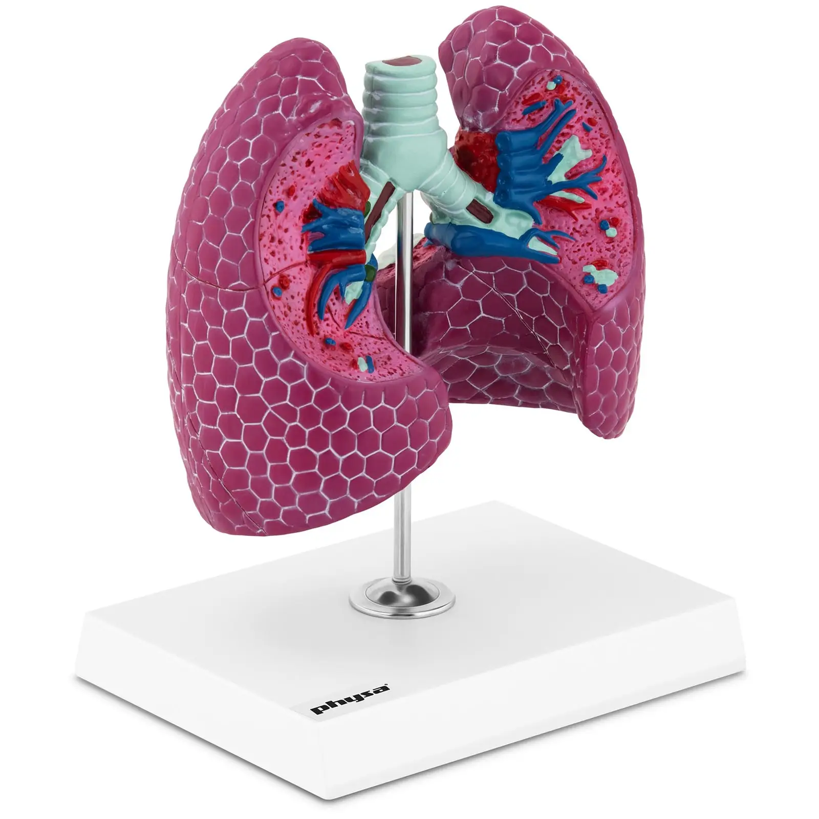 Lungenmodell - mit Pathologien